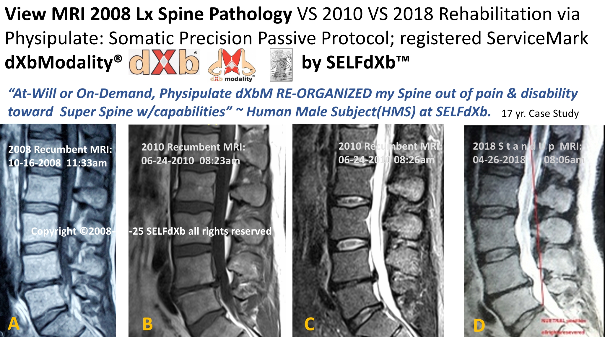 SELFdXb_2008_2010_2018_MRI_copyright2025