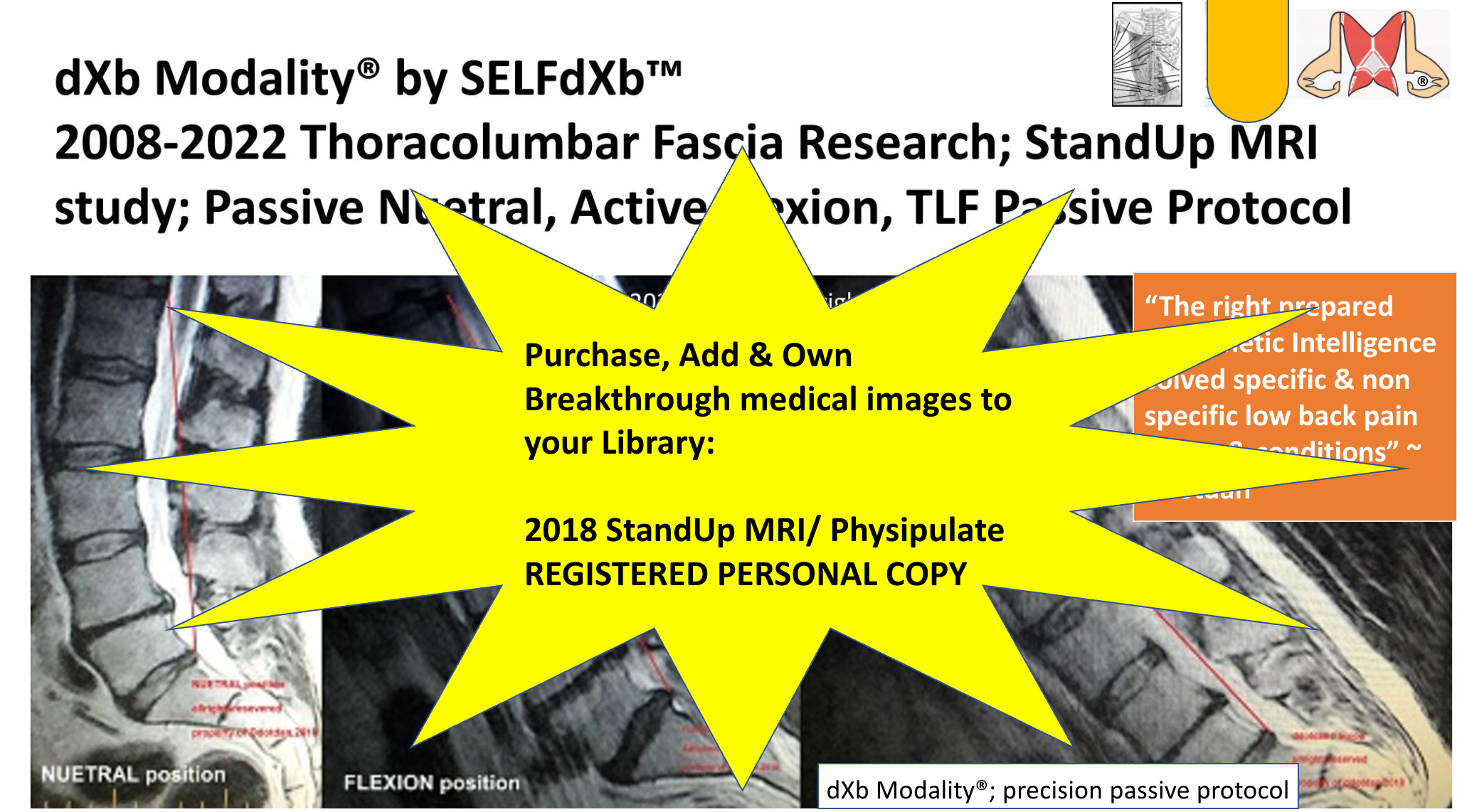 SELFdXb_2018_MRI_ad_copyright2025